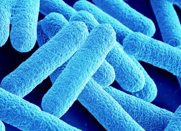 E-Coli disinfezione dell'acqua con UV - Blog Nordic Tec